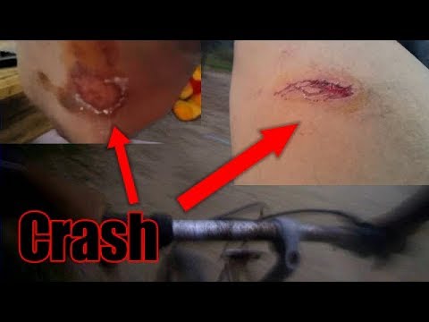Epic fail crash Mountain Bike